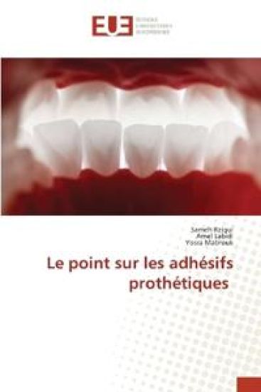 Le point sur les adhésifs prothétiques