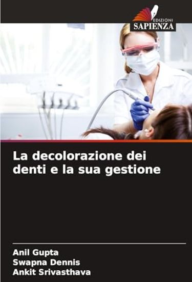 La decolorazione dei denti e la sua gestione