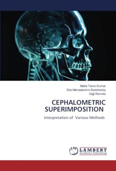 CEPHALOMETRIC SUPERIMPOSITION