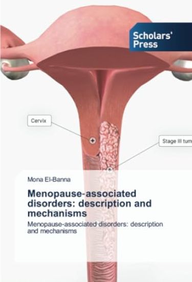 Menopause-associated disorders