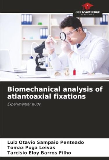 Biomechanical analysis of atlantoaxial fixations