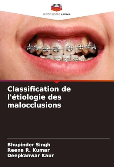 Classification de l'étiologie des malocclusions