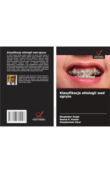Klasyfikacja etiologii wad zgryzu