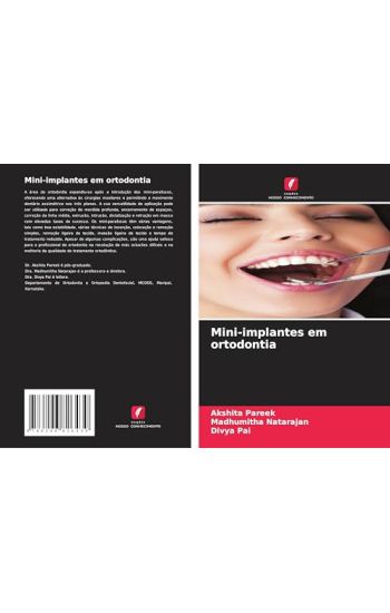 Mini-implantes em ortodontia