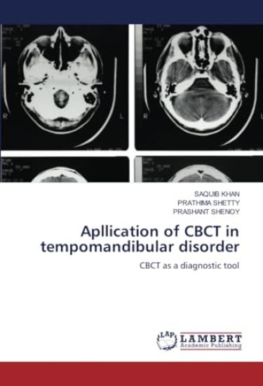 Apllication of CBCT in tempomandibular disorder