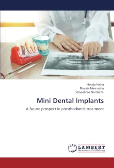 Mini Dental Implants