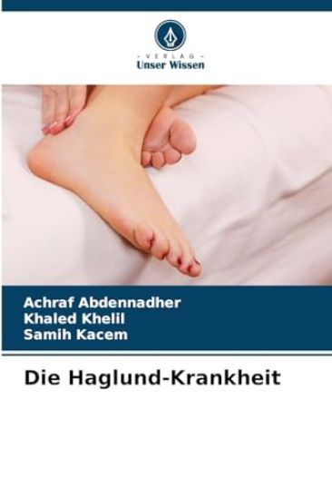 Die Haglund-Krankheit