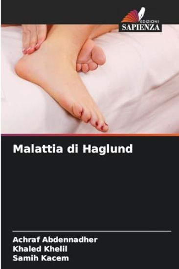 Malattia di Haglund