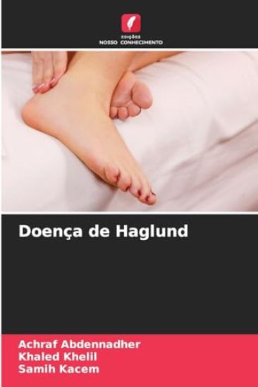 Doença de Haglund