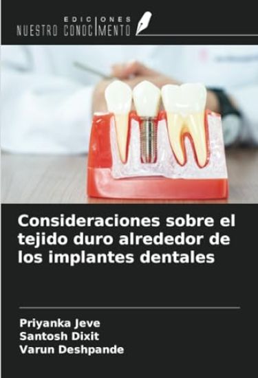 Consideraciones sobre el tejido duro alrededor de los implantes dentales