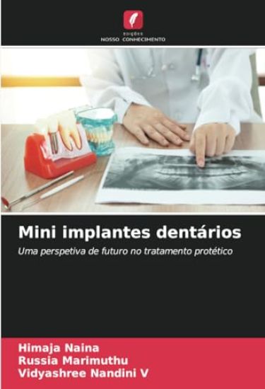 Mini implantes dentários