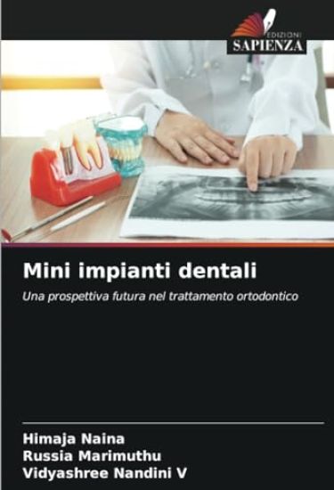 Mini impianti dentali