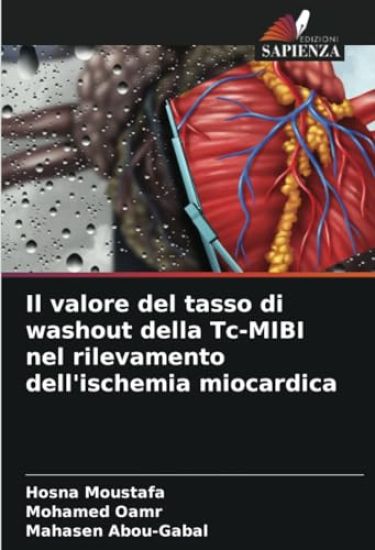 Il valore del tasso di washout della Tc-MIBI nel rilevamento dell'ischemia miocardica