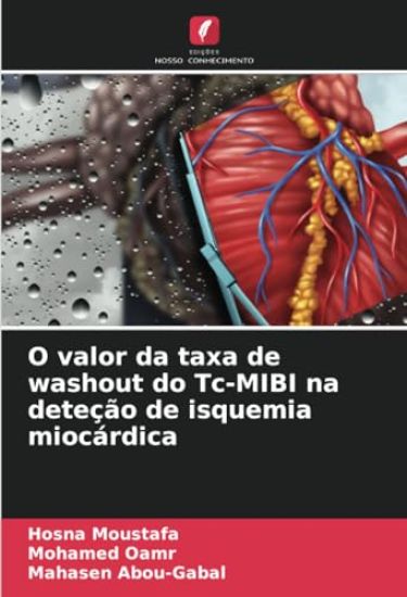 O valor da taxa de washout do Tc-MIBI na deteção de isquemia miocárdica