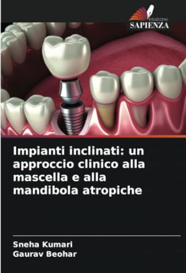 Impianti inclinati