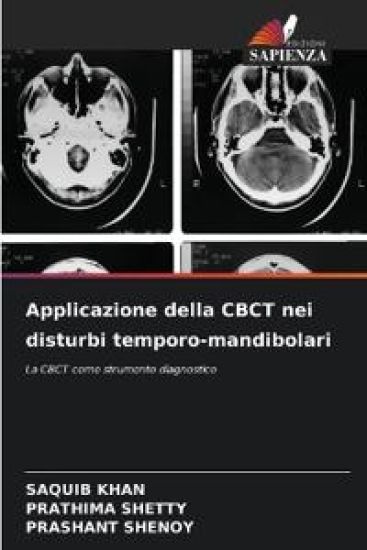 Applicazione della CBCT nei disturbi temporo-mandibolari