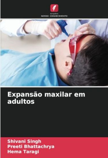 Expansão maxilar em adultos