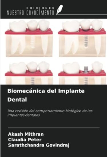 Biomecánica del Implante Dental