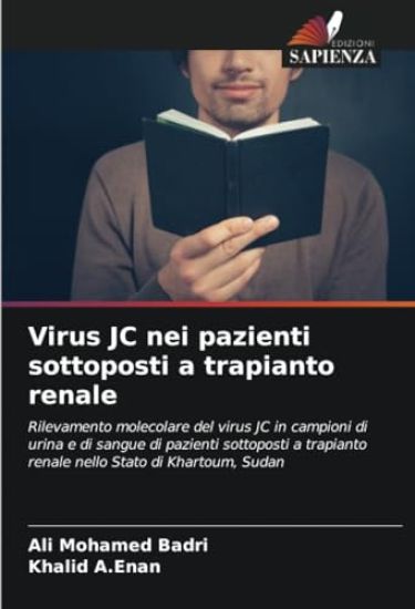 Virus JC nei pazienti sottoposti a trapianto renale