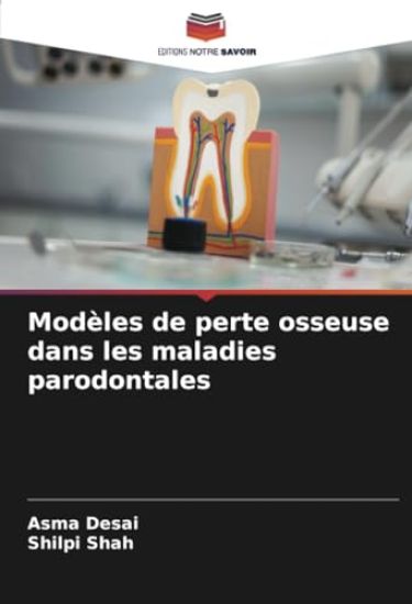 Modèles de perte osseuse dans les maladies parodontales