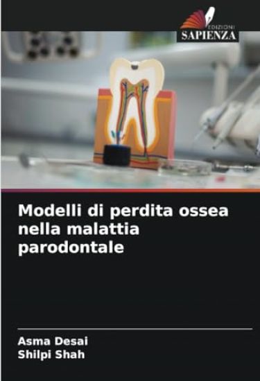 Modelli di perdita ossea nella malattia parodontale