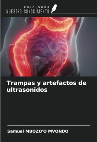Trampas y artefactos de ultrasonidos