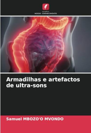 Armadilhas e artefactos de ultra-sons