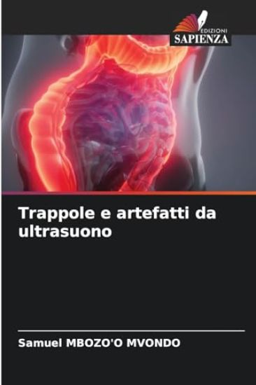 Trappole e artefatti da ultrasuono