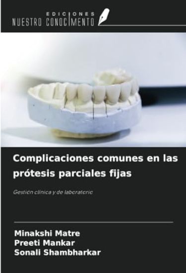 Complicaciones comunes en las prótesis parciales fijas