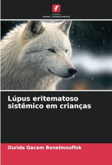 Lúpus eritematoso sistêmico em crianças