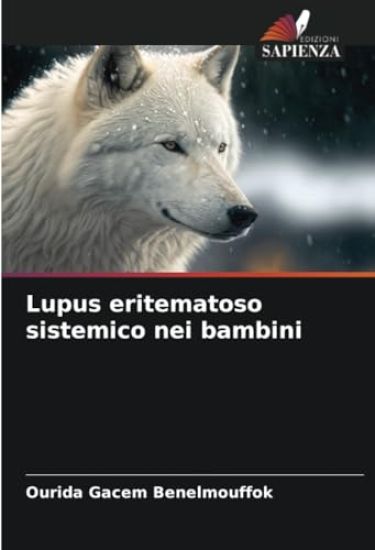 Lupus eritematoso sistemico nei bambini