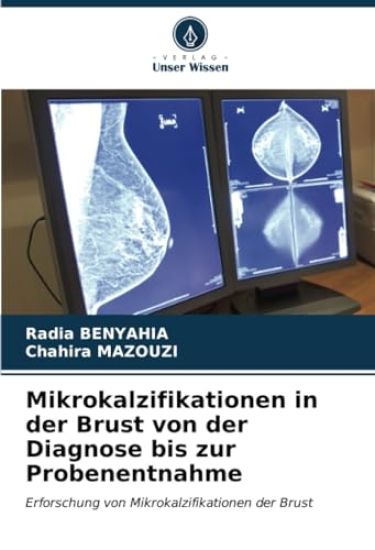 Mikrokalzifikationen in der Brust von der Diagnose bis zur Probenentnahme