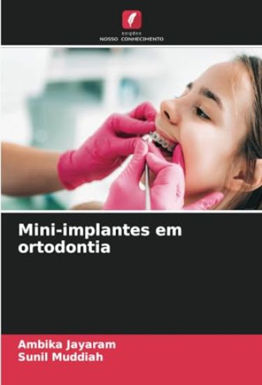 Mini-implantes em ortodontia
