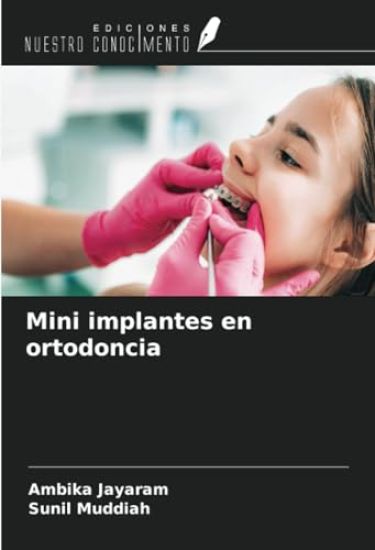 Mini implantes en ortodoncia
