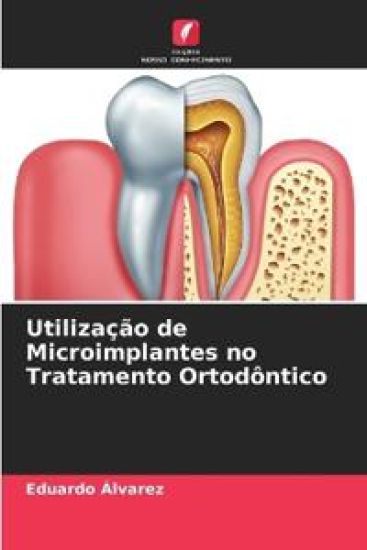 Utilização de Microimplantes no Tratamento Ortodôntico