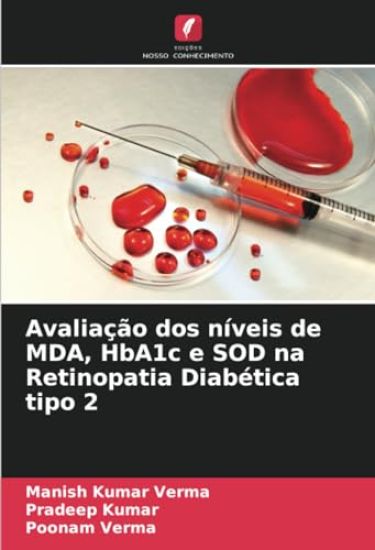 Avaliação dos níveis de MDA, HbA1c e SOD na Retinopatia Diabética tipo 2