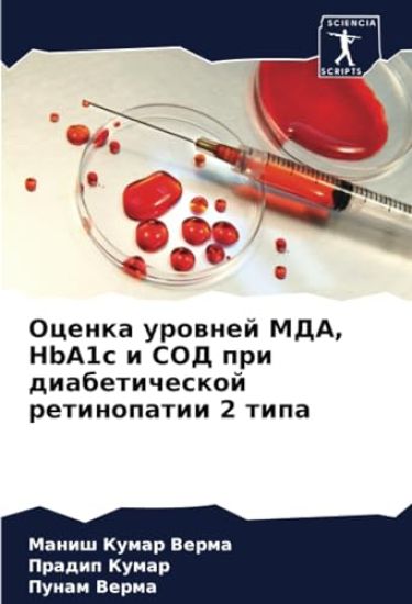 Ocenka urownej MDA, HbA1c i SOD pri diabeticheskoj retinopatii 2 tipa