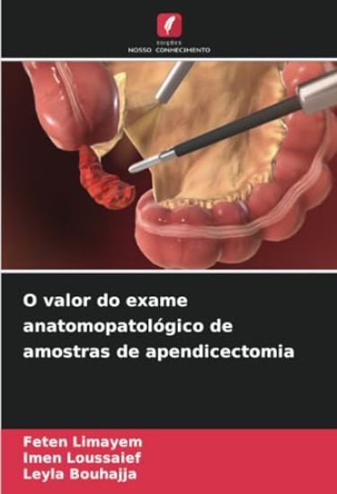 O valor do exame anatomopatológico de amostras de apendicectomia