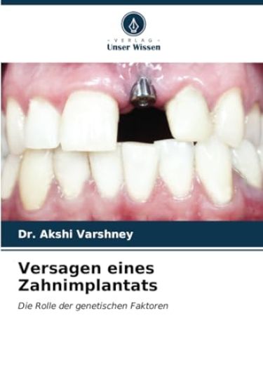 Versagen eines Zahnimplantats