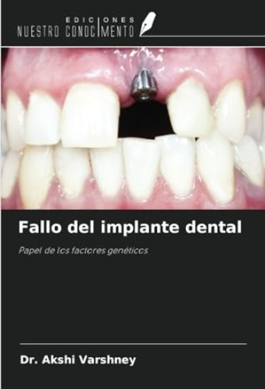 Fallo del implante dental