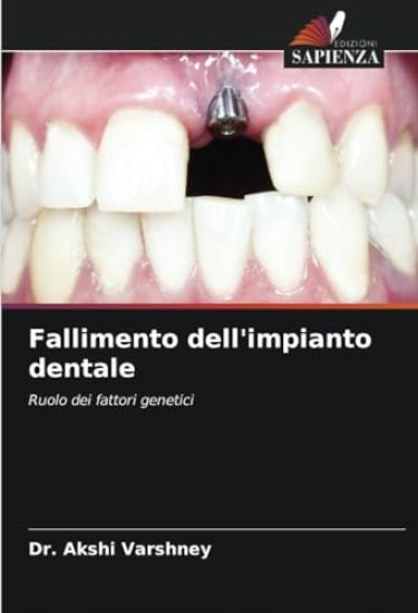 Fallimento dell'impianto dentale