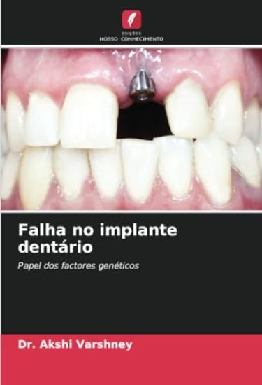 Falha no implante dentário