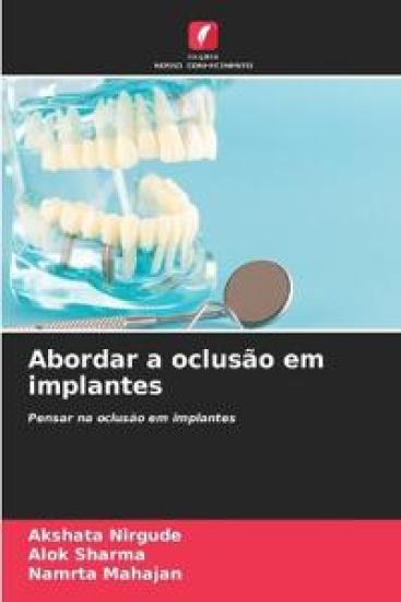Abordar a oclusão em implantes
