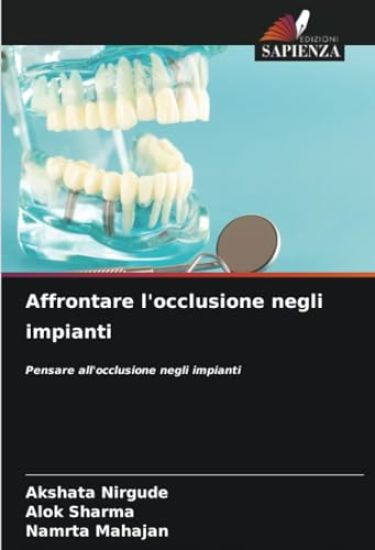 Affrontare l'occlusione negli impianti