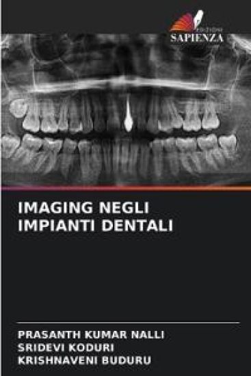 Imaging Negli Impianti Dentali