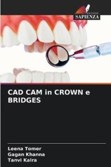 CAD CAM in CROWN e BRIDGES