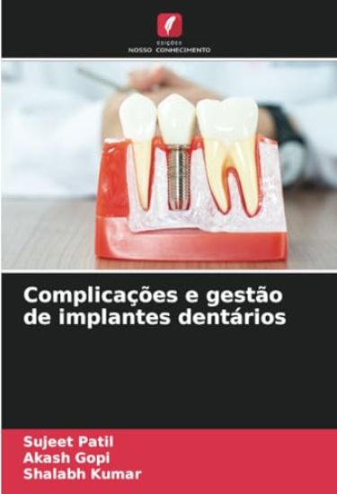 Complicações e gestão de implantes dentários