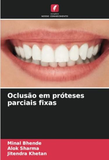 Oclusão em próteses parciais fixas