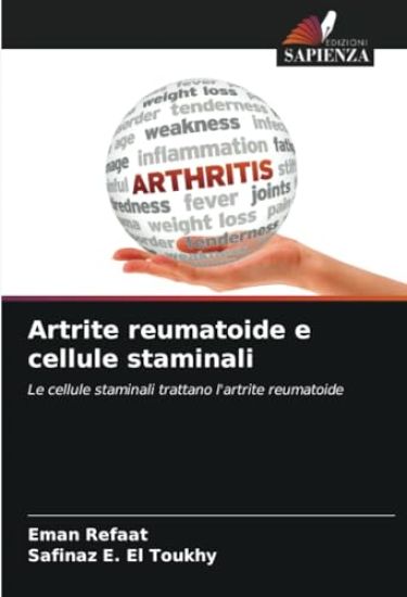 Artrite reumatoide e cellule staminali