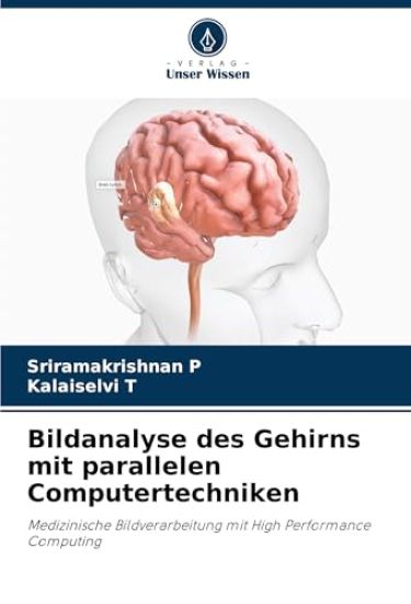 Bildanalyse des Gehirns mit parallelen Computertechniken